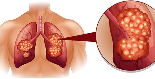 پیشگامان شفاگستران سام